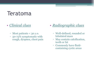 Teratoma
• Clinical clues
▫ Most patients < 30 y.o.
▫ 50-75% symptomatic with
cough, dyspnea, chest pain
• Radiographic clues
▫ Well-defined, rounded or
lobulated mass
▫ May contain calcification,
teeth or fat
▫ Commonly have fluid-
containing cystic areas
 