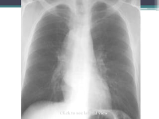 Click to see lateral view
 