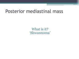 Posterior mediastinal mass
What is it?
„Shwannoma‟
 