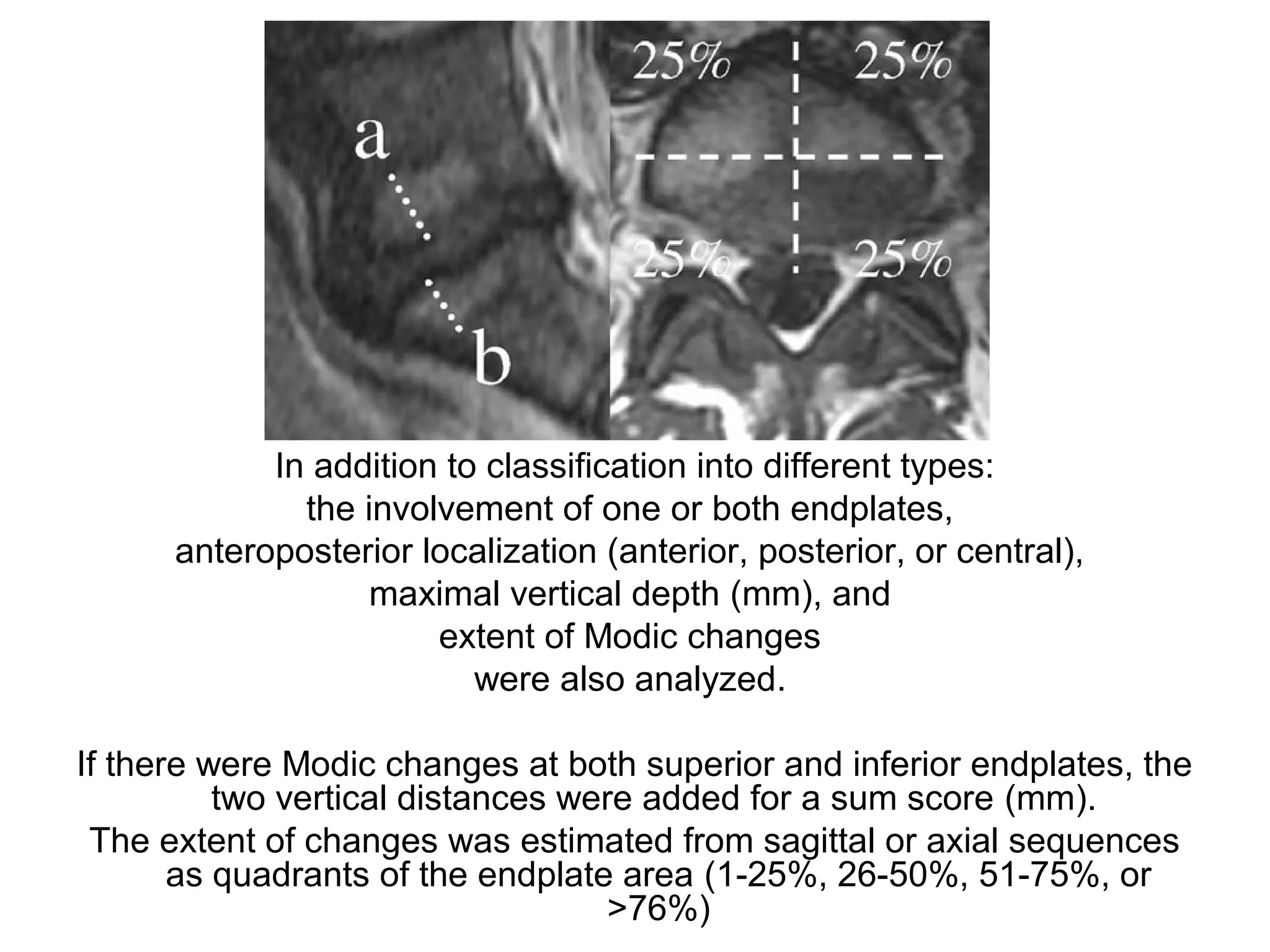 In addition to classification into different types: 
the involvement of one or both endplates, 
anteroposterior localization (anterior, posterior, or central), 
maximal vertical depth (mm), and 
extent of Modic changes 
were also analyzed. 
If there were Modic changes at both superior and inferior endplates, the 
two vertical distances were added for a sum score (mm). 
The extent of changes was estimated from sagittal or axial sequences 
as quadrants of the endplate area (1-25%, 26-50%, 51-75%, or 
>76%) 
 