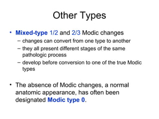 Other Types 
• Mixed-type 1/2 and 2/3 Modic changes 
– changes can convert from one type to another 
– they all present different stages of the same 
pathologic process 
– develop before conversion to one of the true Modic 
types 
• The absence of Modic changes, a normal 
anatomic appearance, has often been 
designated Modic type 0. 
 
