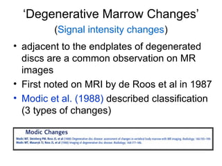 ‘Degenerative Marrow Changes’ 
(Signal intensity changes) 
• adjacent to the endplates of degenerated 
discs are a common observation on MR 
images 
• First noted on MRI by de Roos et al in 1987 
• Modic et al. (1988) described classification 
(3 types of changes) 
 