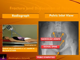 The modification plain radiographic of pelvis | PDF