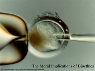 The Moral Implications of Bioethics http://randallhmiller.com/playing-god-with-stem-cell-research / 