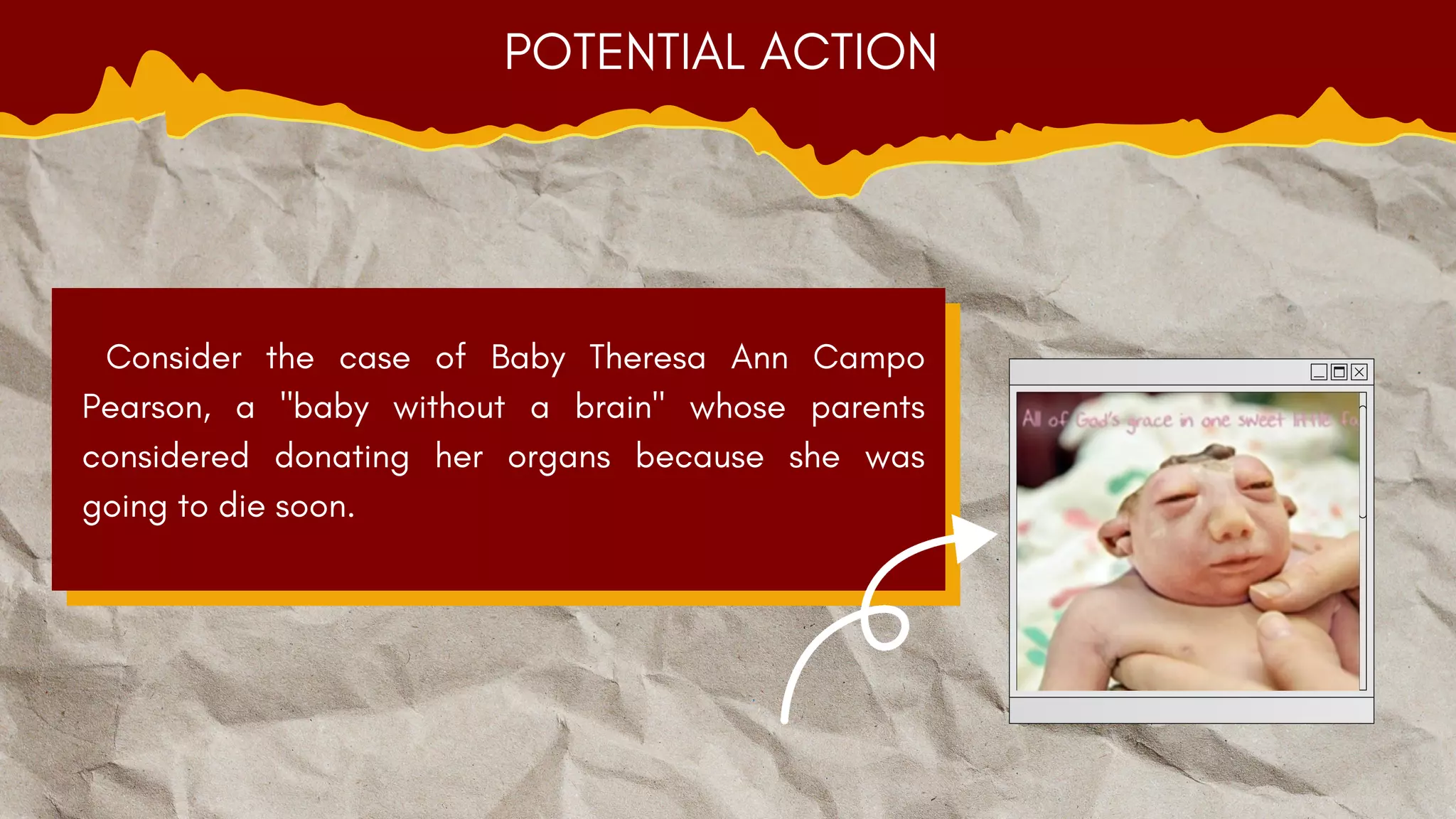 Consider the case of Baby Theresa Ann Campo
Pearson, a "baby without a brain" whose parents
considered donating her organs because she was
going to die soon.
POTENTIAL ACTION
 