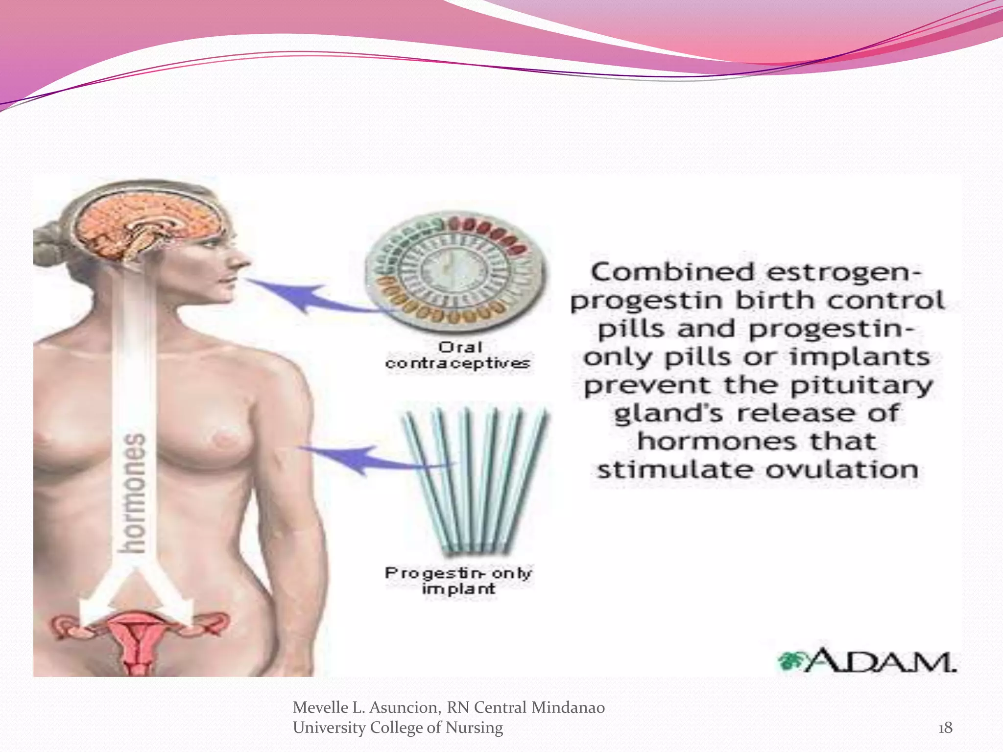Mevelle L. Asuncion, RN Central Mindanao
University College of Nursing              18
 