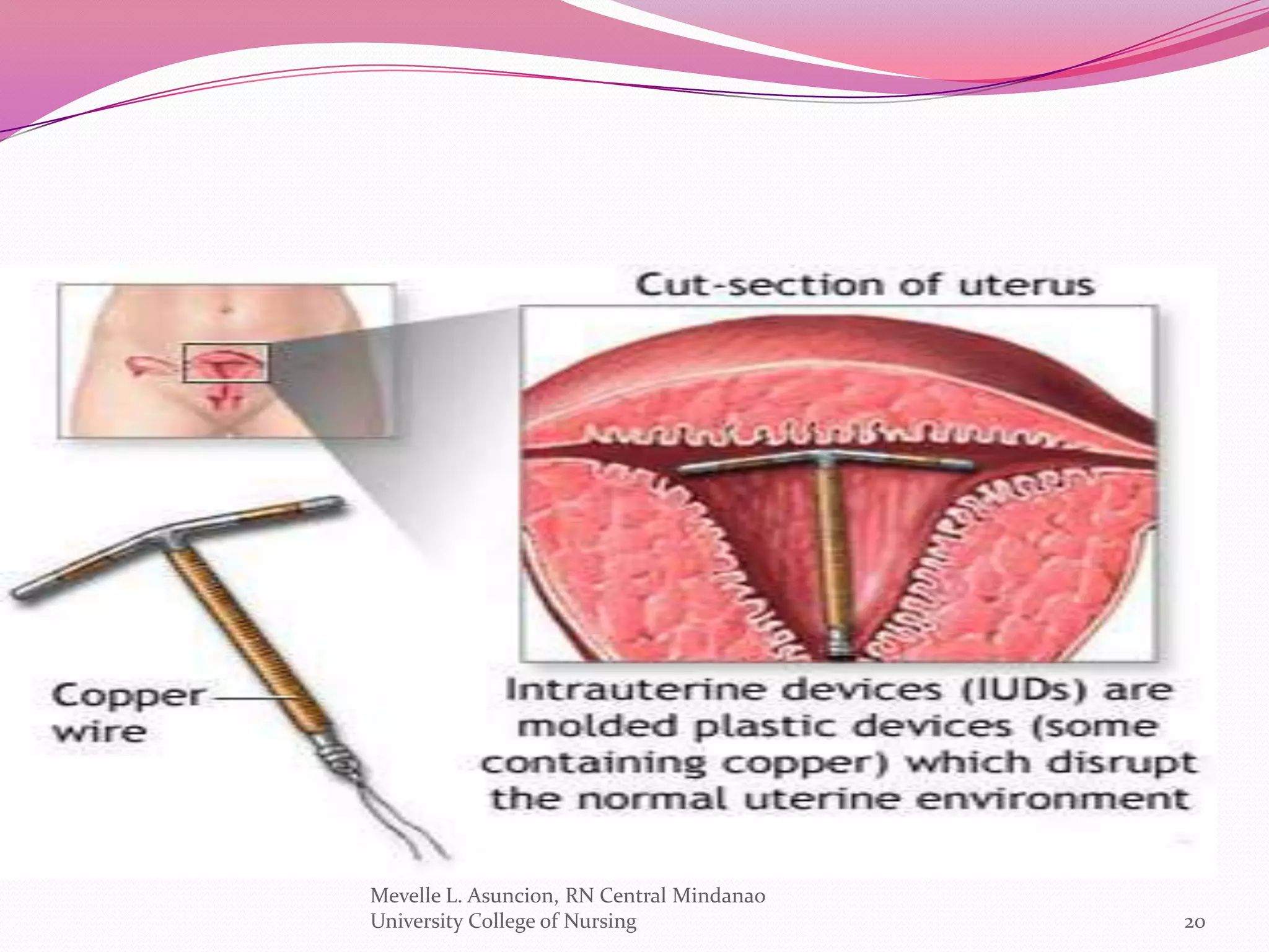 Mevelle L. Asuncion, RN Central Mindanao
University College of Nursing              20
 