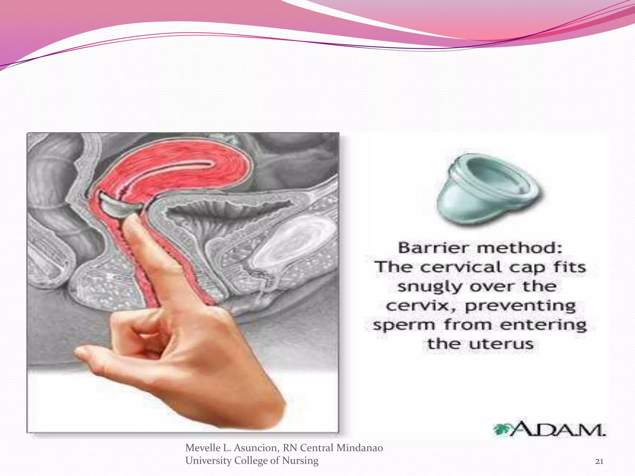 Mevelle L. Asuncion, RN Central Mindanao
University College of Nursing              21
 