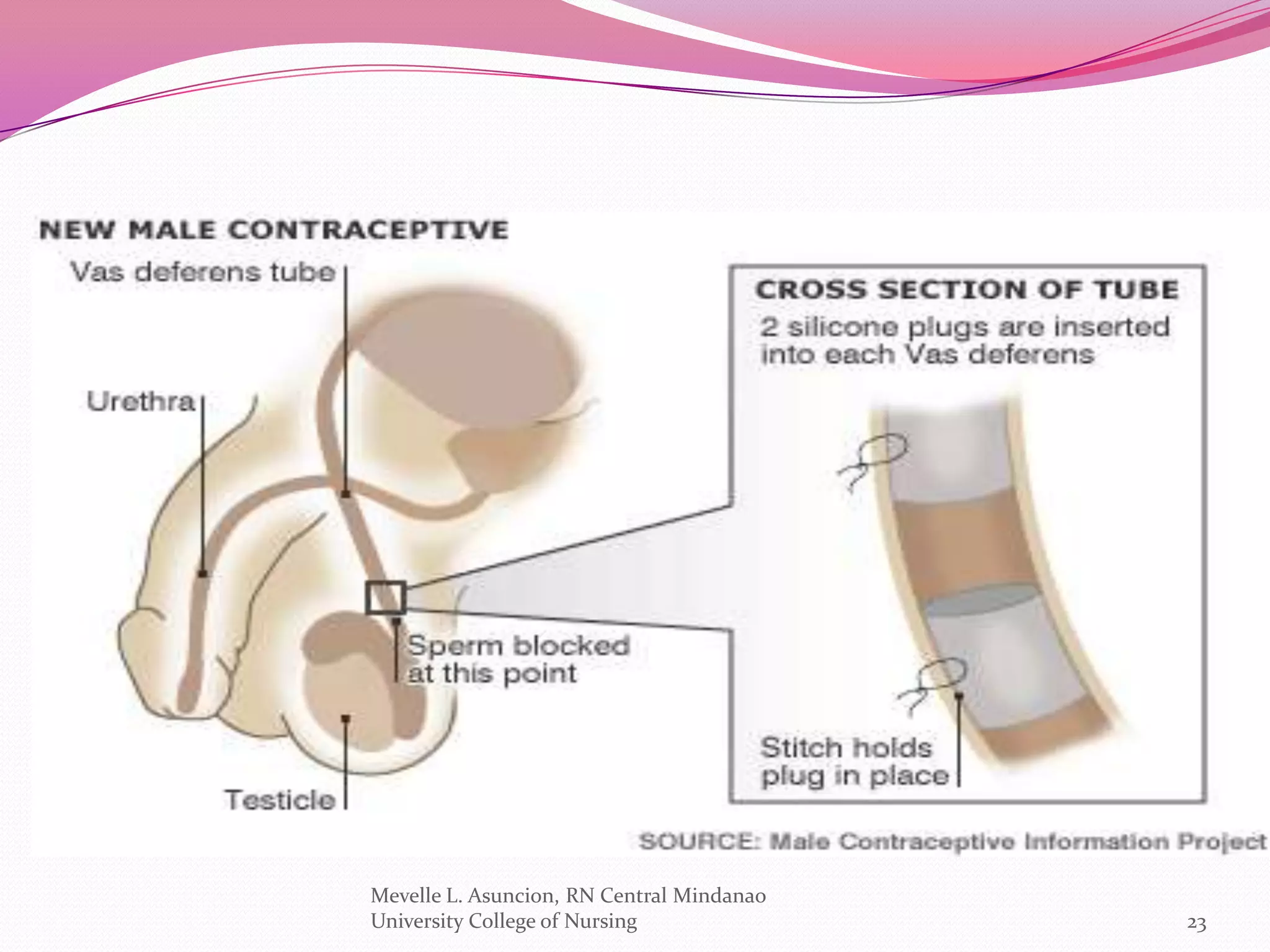 Mevelle L. Asuncion, RN Central Mindanao
University College of Nursing              23
 