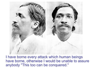 I have borne every attack which human beings
have borne, otherwise I would be unable to assure
anybody "This too can be conquered."
 
