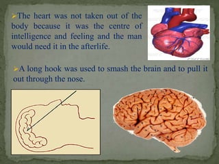 The heart was not taken out of the 
body because it was the centre of 
intelligence and feeling and the man 
would need it in the afterlife. 
A long hook was used to smash the brain and to pull it 
out through the nose. 
 