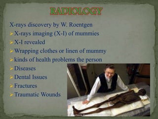 X-rays discovery by W. Roentgen 
X-rays imaging (X-I) of mummies 
X-I revealed 
Wrapping clothes or linen of mummy 
kinds of health problems the person 
Diseases 
Dental Issues 
Fractures 
Traumatic Wounds 
 