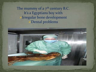 The mummy of a 7th century B.C. 
It’s a Egyptians boy with 
Irregular bone development 
Dental problems 
 