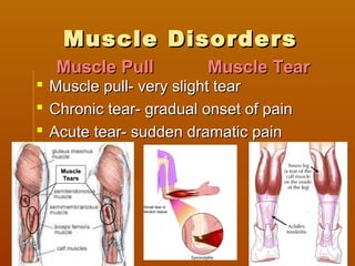 Muscle DisordersMuscle Disorders
 Muscle pull- very slight tearMuscle pull- very slight tear
 Chronic tear- gradual onset of painChronic tear- gradual onset of pain
 Acute tear- sudden dramatic painAcute tear- sudden dramatic pain
Muscle PullMuscle Pull Muscle TearMuscle Tear
MuscleMuscle
TearsTears
 