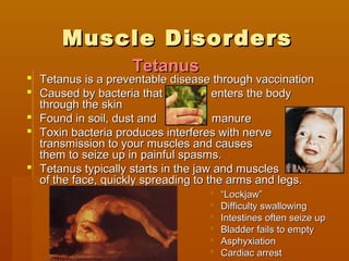Muscle DisordersMuscle Disorders
 Tetanus is a preventable disease through vaccinationTetanus is a preventable disease through vaccination
 Caused by bacteria that enters the bodyCaused by bacteria that enters the body
through the skinthrough the skin
 Found in soil, dust and manureFound in soil, dust and manure
 Toxin bacteria produces interferes with nerveToxin bacteria produces interferes with nerve
transmission to your muscles and causestransmission to your muscles and causes
them to seize up in painful spasms.them to seize up in painful spasms.
 Tetanus typically starts in the jaw and musclesTetanus typically starts in the jaw and muscles
of the face, quickly spreading to the arms and legs.of the face, quickly spreading to the arms and legs.
 ““Lockjaw”Lockjaw”
 Difficulty swallowingDifficulty swallowing
 Intestines often seize upIntestines often seize up
 Bladder fails to emptyBladder fails to empty
 AsphyxiationAsphyxiation
 Cardiac arrestCardiac arrest
TetanusTetanus
 