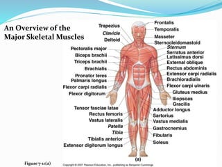An Overview of the
Major Skeletal Muscles
Figure 7-11(a)
 