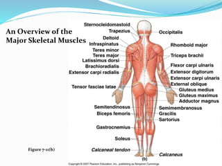 An Overview of the
Major Skeletal Muscles
Figure 7-11(b)
 