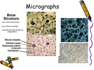 Micrographs
 