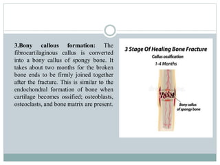 Bone Callouses The musculoskeletal system Anatomy and physiology | PPTX