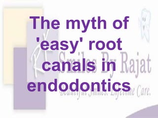 The myth of
'easy' root
canals in
endodontics
 