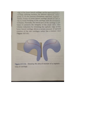 The nasal tip & nasolabial angle