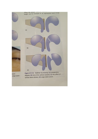 The nasal tip & nasolabial angle