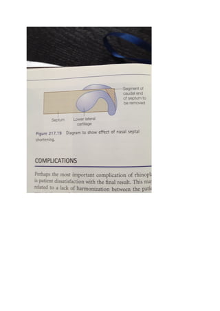 The nasal tip & nasolabial angle
