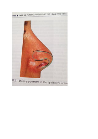 The nasal tip & nasolabial angle
