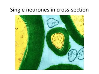 Single neurones in cross-section
 