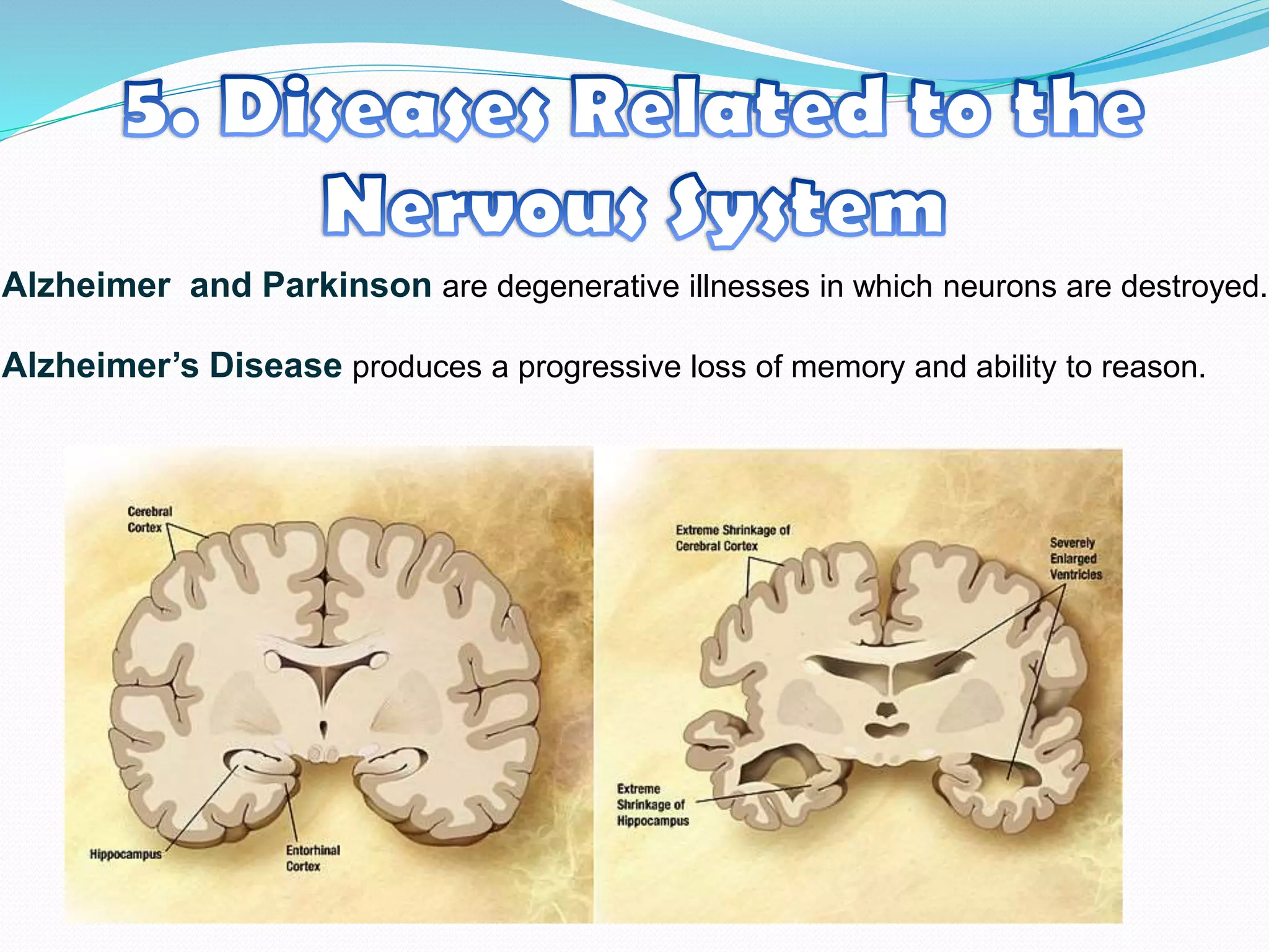 Alzheimer and Parkinson are degenerative illnesses in which neurons are destroyed.
Alzheimer’s Disease produces a progressive loss of memory and ability to reason.
 