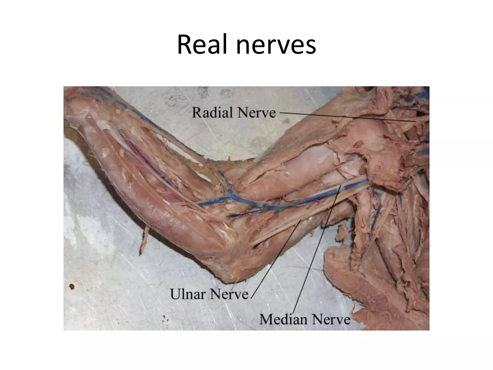 Real nerves
 