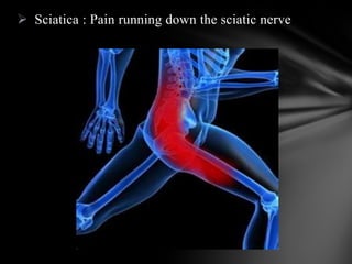  Sciatica : Pain running down the sciatic nerve
 