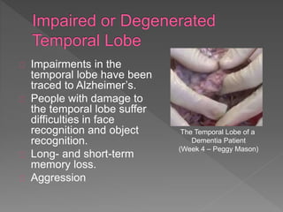Impairments in the
temporal lobe have been
traced to Alzheimer’s.
People with damage to
the temporal lobe suffer
difficulties in face
recognition and object
recognition.
Long- and short-term
memory loss.
Aggression
The Temporal Lobe of a
Dementia Patient
(Week 4 – Peggy Mason)
 