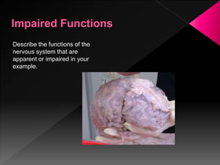 Describe the functions of the
nervous system that are
apparent or impaired in your
example.
 