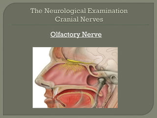 Olfactory Nerve
 