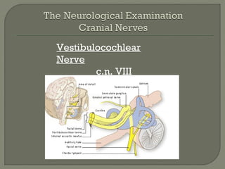 Vestibulocochlear
Nerve
c.n. VIII
 