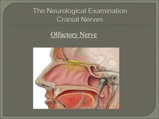 Olfactory Nerve
 