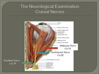 Trochlear Nerve
c.n. IV
Oculomotor Nerve
Cn III
Abducens Nerve
Cn VI
 