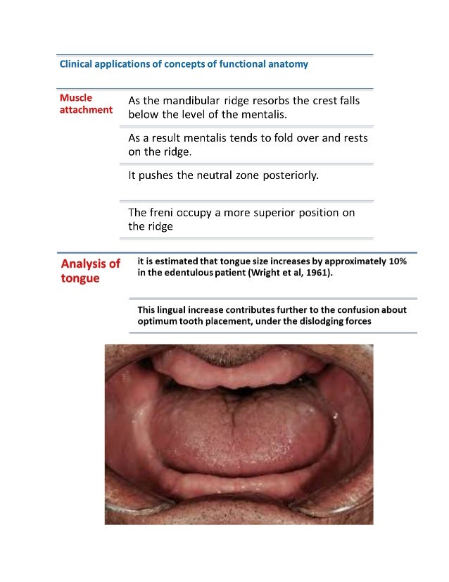 The neutral zone concept in complete denture final