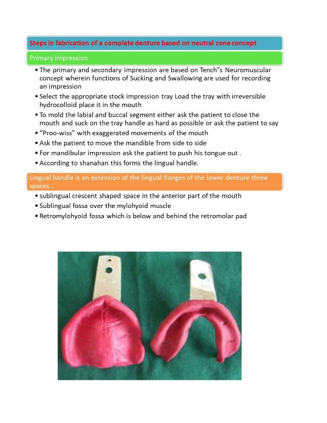 The neutral zone concept in complete denture final