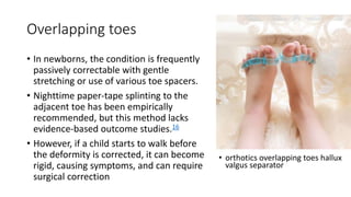 Overlapping toes
• In newborns, the condition is frequently
passively correctable with gentle
stretching or use of various toe spacers.
• Nighttime paper-tape splinting to the
adjacent toe has been empirically
recommended, but this method lacks
evidence-based outcome studies.16
• However, if a child starts to walk before
the deformity is corrected, it can become
rigid, causing symptoms, and can require
surgical correction
• orthotics overlapping toes hallux
valgus separator
 