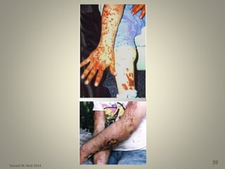 Donald W. Reid 2014
39
 