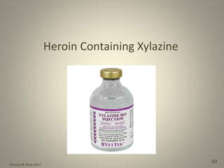Donald W. Reid 2014
49
Heroin Containing Xylazine
 