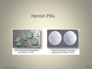 Donald W. Reid 2014
61
Heroin Pills
 