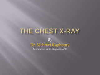 The Chest X-ray By Dr. MehmetKaphoury Residence of radio-diagnosis, ASU 