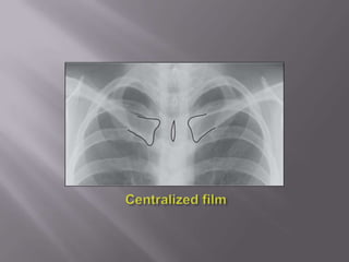 Centralized film