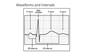 Waveforms and Intervals