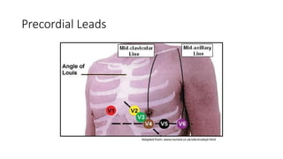 Precordial Leads
Adapted from: www.numed.co.uk/electrodepl.html