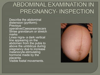 -   Describe the abdominal
    distension (pyriform).
-   Previous
    operative(Caesarean)scars
-   Striae gravidarum or stretch
    marks
-   Linea nigra- a dark vertical
    line appearing on the
    abdomen from the pubis to
    above the umbilicus during
    pregnancy due to increase
    melanocyte-stimulating
    hormone made by the
    placenta.
-   Visible foetal movements.
 