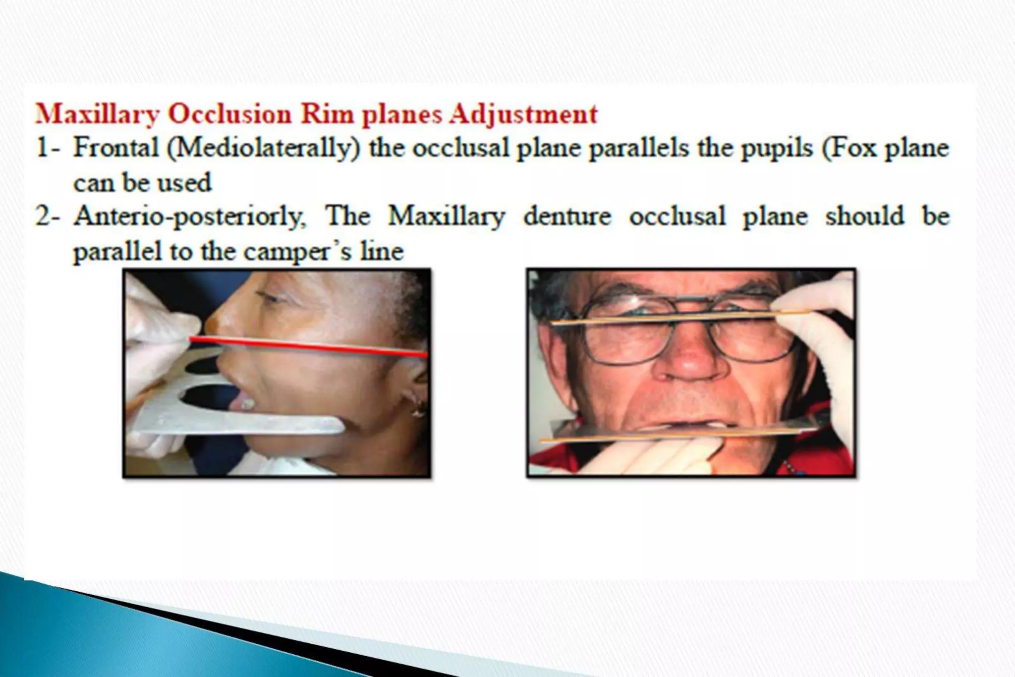 Occlusal Rim Inclinator The occlusal rims and record | PPTX